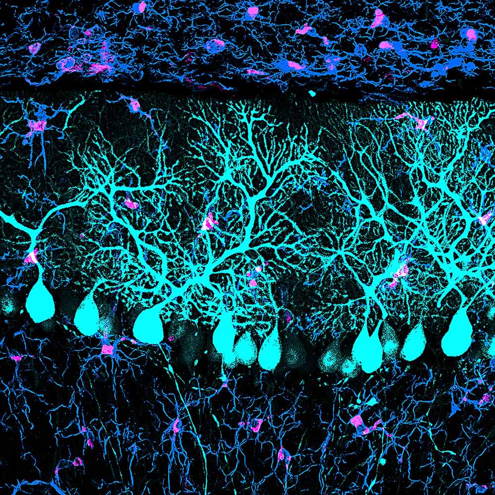 Les scientifiques découvrent pourquoi Ozempic peut ne pas fonctionner pour certaines personnes.